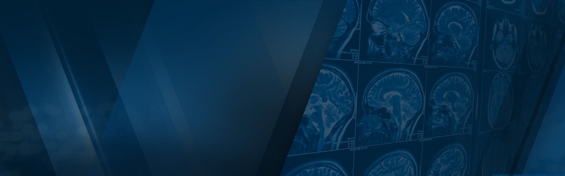 Traumatic Brain Injuries
